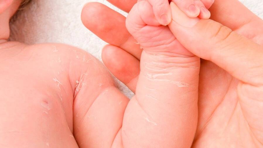 Advirtieron por el impacto de los despidos en el Programa de Cardiopatías Congénitas