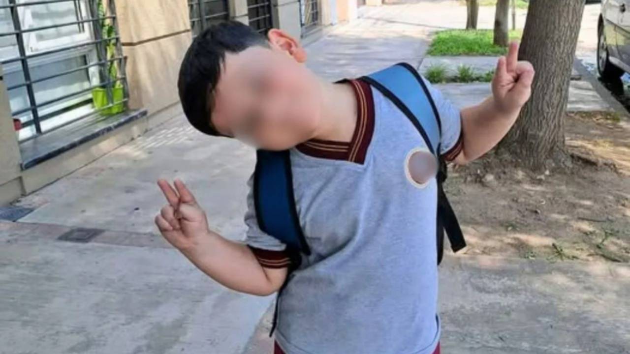 Operan por tercera vez al niño que chocó a bordo de un UTV en Pinamar