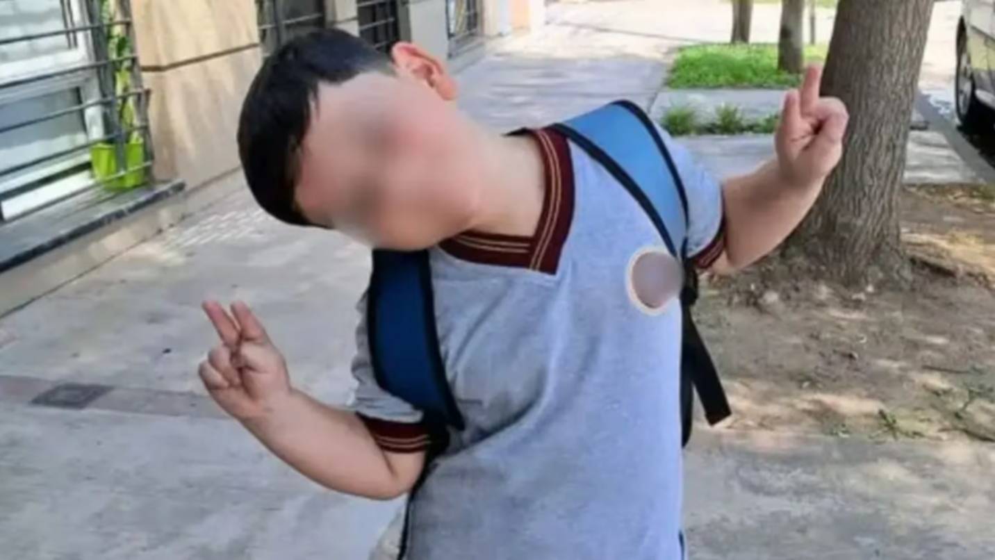 Qué dice el último parte médico de Bastián, el nene de 8 años que sufrió un accidente en Pinamar