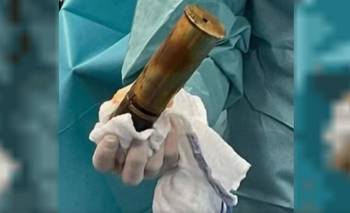 Evacúan hospital en Toulouse por proyectil de la Primera Guerra Mundial alojado en un paciente