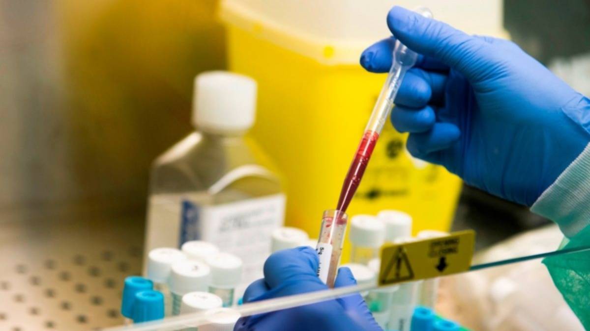 Gerbich negativo: detectan en Argentina seis casos de un rarísimo grupo sanguíneo