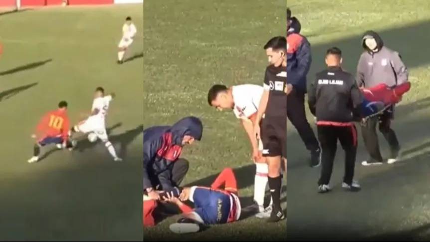 Estremecedora lesión en el fútbol de ascenso: ¡triple rotura de rodilla y más de un año sin jugar!