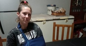 Choque y fuga: "Espero que dé la cara", dijo la motociclista lesionada