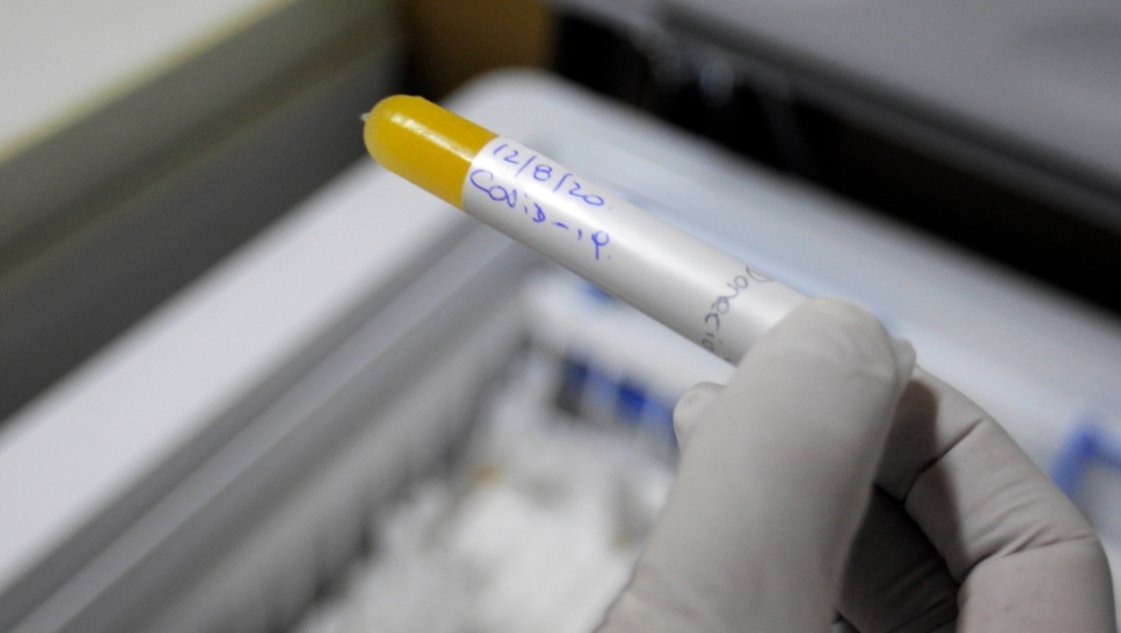 Comenzarán a confirmar casos positivos de coronavirus sin hisopados Comenzarán a confirmar casos positivos de coronavirus sin hisopados