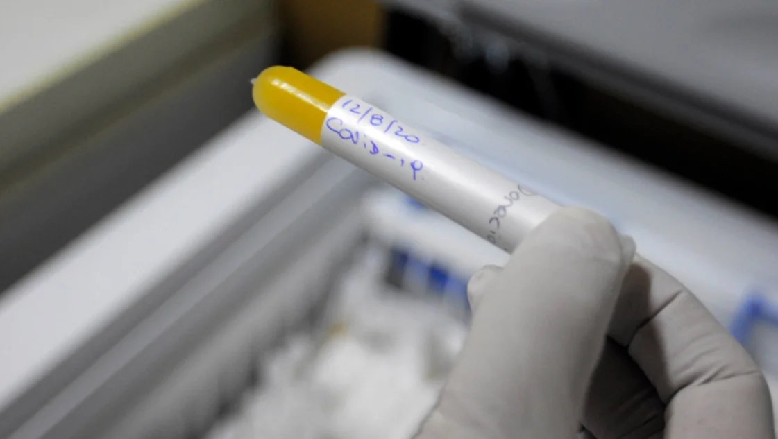 Comenzarán a confirmar casos positivos de coronavirus sin hisopados