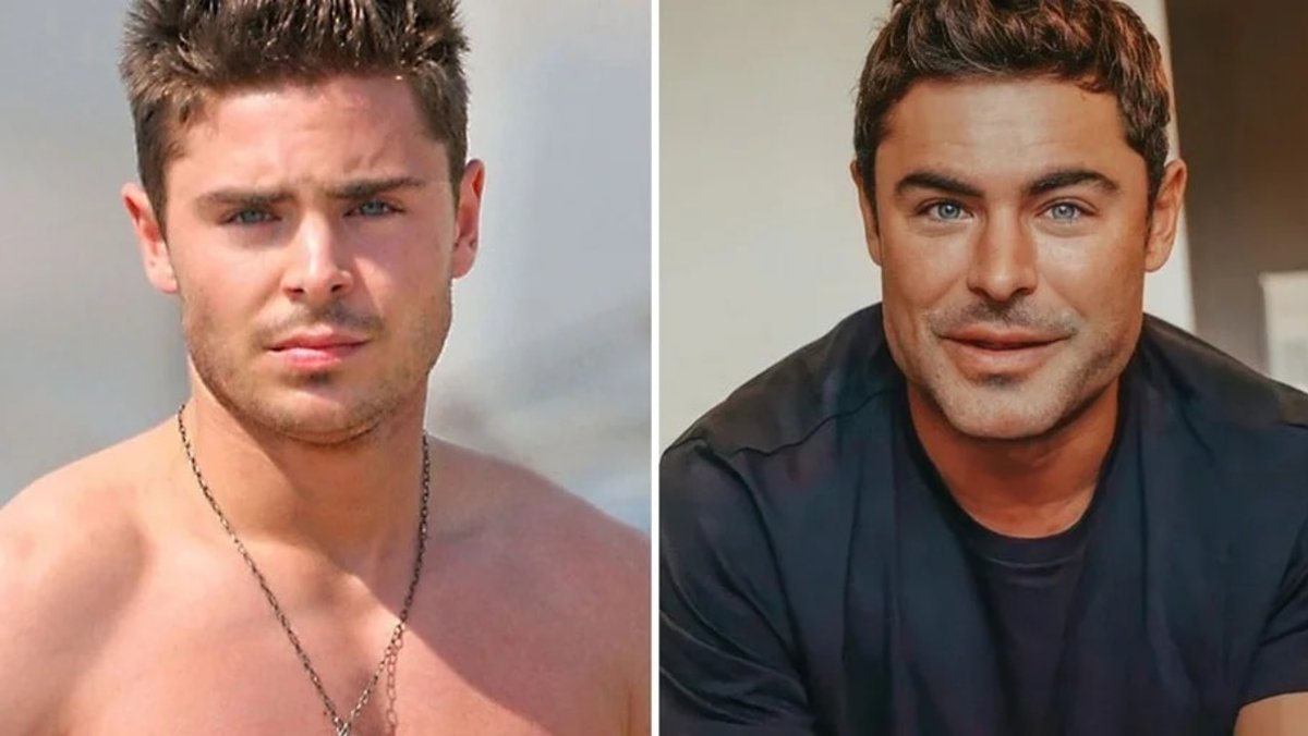 Zac Efron explicó el motivo que ocasionó los llamativos cambios en su rostro