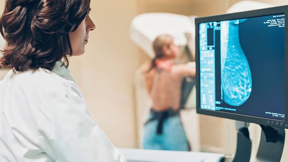 Cáncer de mama: 4 de cada 10 mujeres en Argentina no se realizan la mamografía regularmente